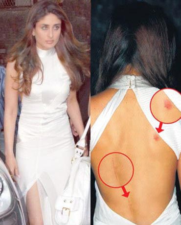 8 Artis Bollywood dengan Tanda Merah di Tubuh, Salman Khan Buat Curiga