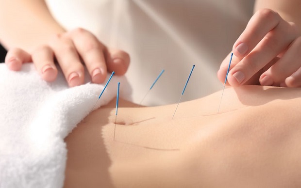Acupuncture relieve period pain