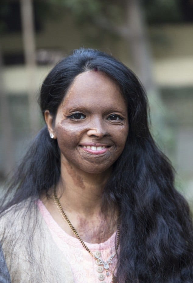 Laxmi Agarwal Acid attack survivor