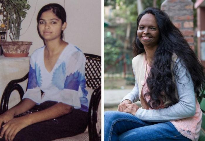 laxmi agarwal before face