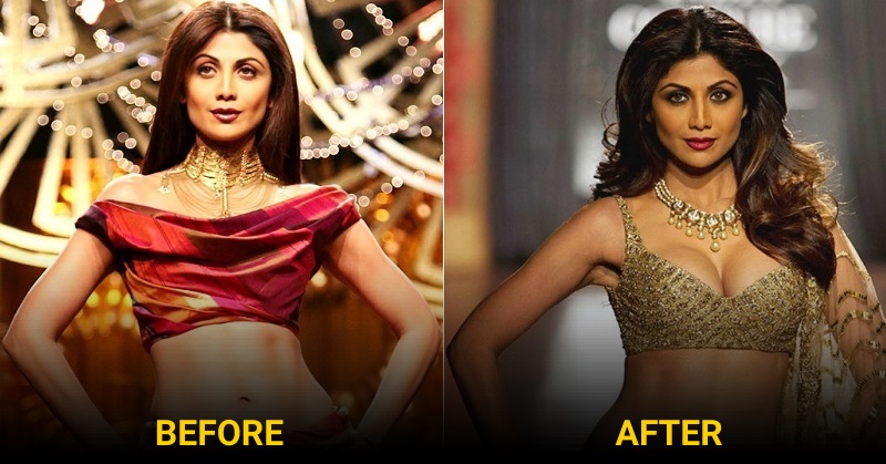 Bollywood Celebrities with breast implants