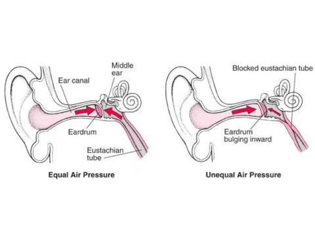 ear pain reason during flight