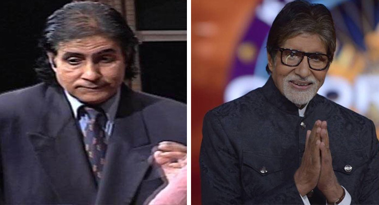 Amitabh Bachchan hair loss