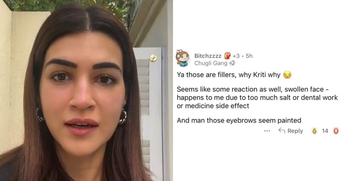 kriti sanon puffy face troll