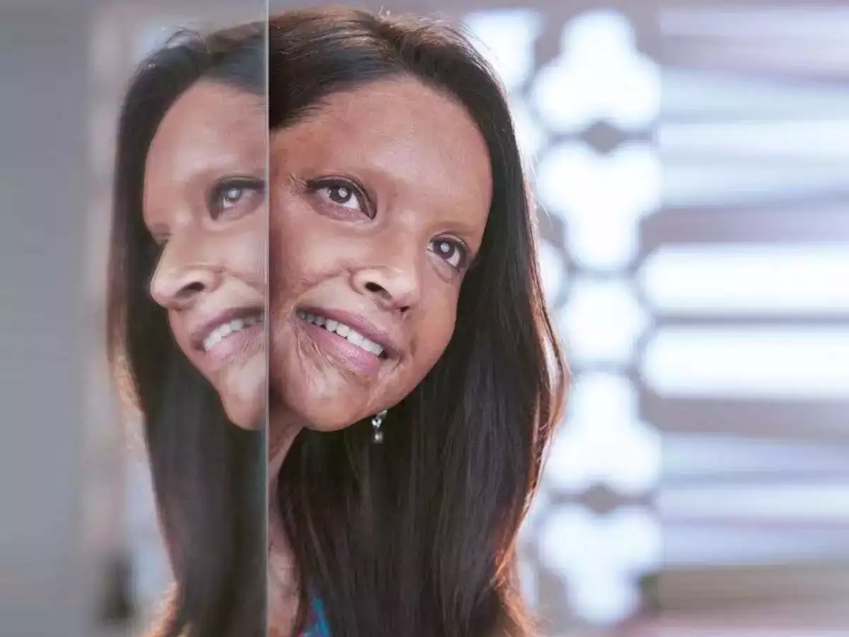 Chhapaak deepika padukone