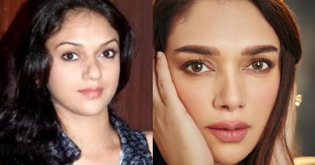 aditi rao hydari plastic surgery