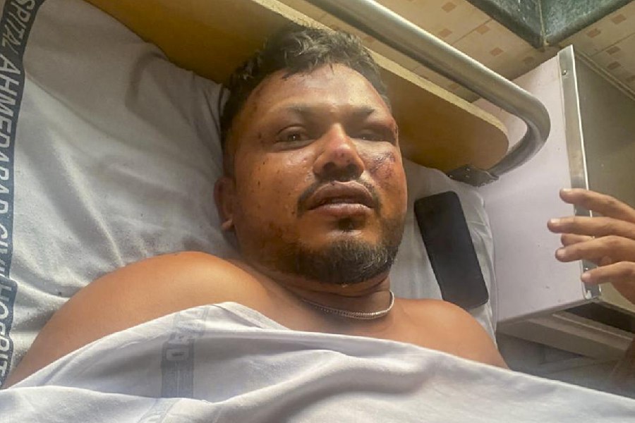 Vishwash-Kumar-Ramesh miracle survivor of Air India crash